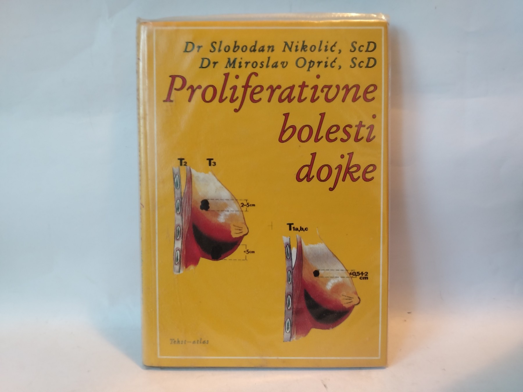 Proliferativne bolesti dojke — S. Nikolić i M. Oprić